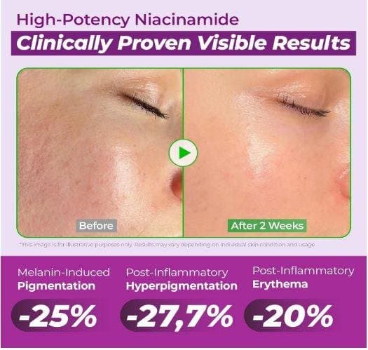 JUMISO Niacinamide 20 Serum 40ml