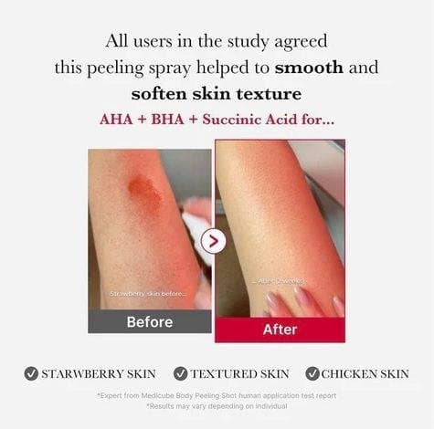 medicube red acne body peeling shot 110g